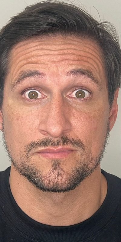 Antes: Botox masculino
